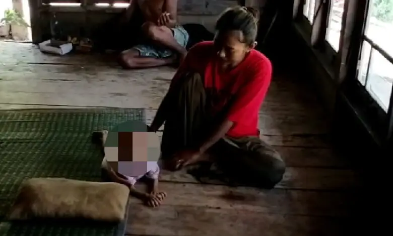 Bayi Berusia 20 Bulan Asal Agrabinta Cianjur Menderita Gizi Buruk