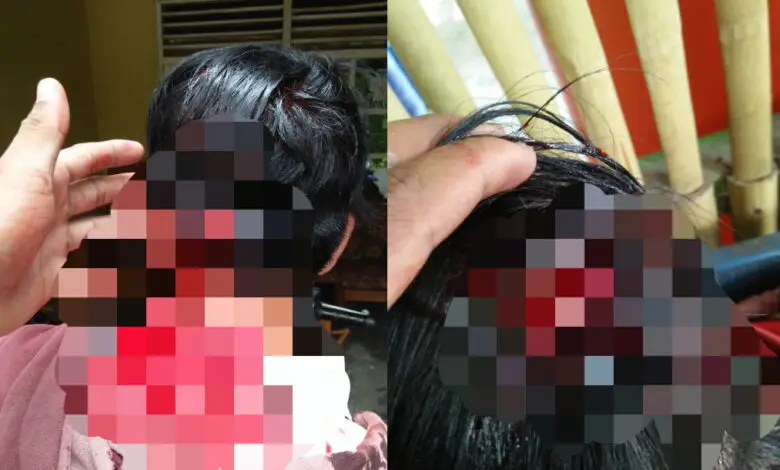 Berdarah-darah, Pelajar di Cianjur Dikeroyok Pakai Gir dan Batu
