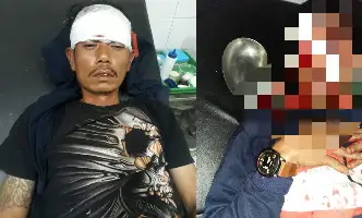 Berdarah-darah, Tukang Ojek di Cibeber Nyaris Dibegal Penumpang