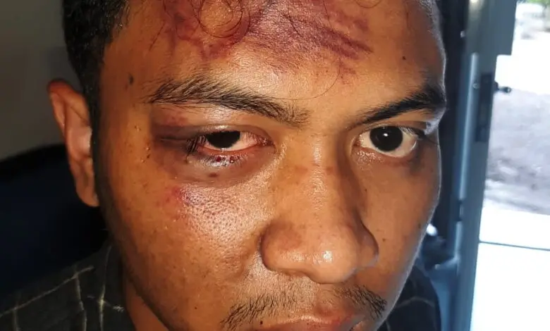 Cerita Irwan, Kader HMI yang Babak Belur Dipukul Polisi