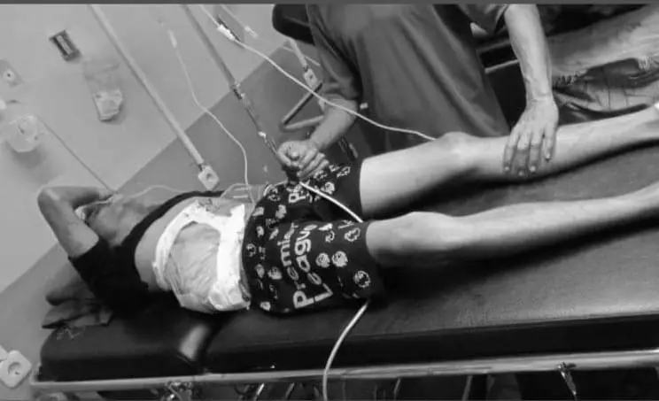 Dua Pemuda di Bojongpicung jadi Korban Pembacokan Orang Tak Dikenal