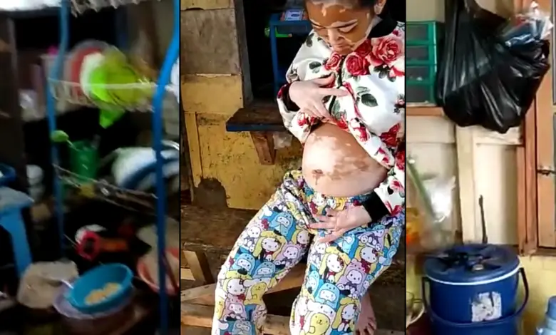 Idap Penyakit Aneh, Keluarga Mira Tak Mampu Periksa ke Dokter