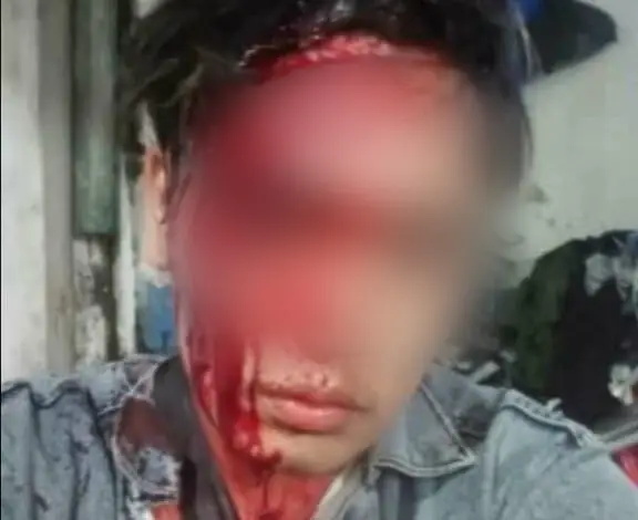 Pemuda di Cianjur Selfie Dengan Berlumuran Darah