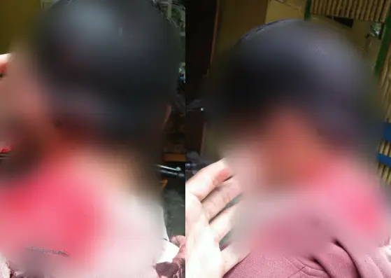 Remaja di Agrabinta Dikeroyok Siswa Aliyah