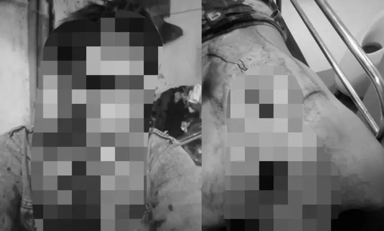 Sembilan Pelaku Pengeroyokan dan Pembacokan di Cianjur Ditangkap