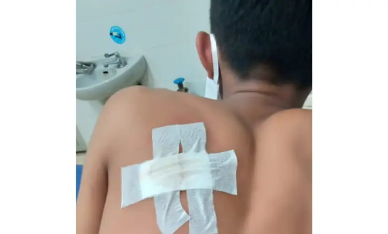 Seorang Pelajar jadi Korban Pembacokan di Agrabinta