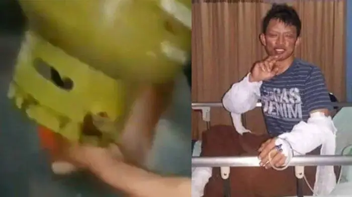 Unboxing LPG Palsu, Pemuda Ini Terbakar