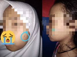 Anak SD di Cianjur Ditampar Guru, Orang Tua Tidak Terima