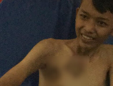 Kisah M Sujana, Tiga Tahun Mengidap TBC Kulit Kini Bisa Berobat