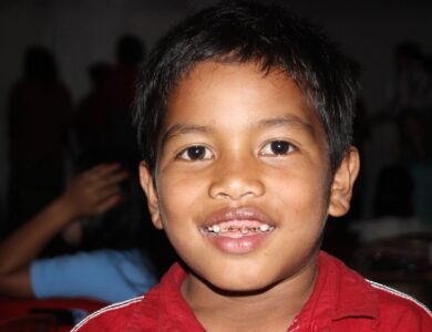 Angka Kerusakan Gigi Pada Anak di Cianjur Masih Tinggi