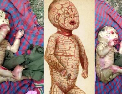 Viral Video Bayi Aneh di India, Ini Penjelasannya