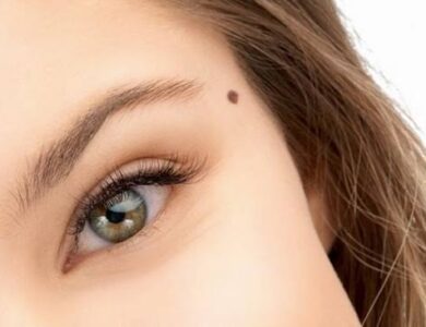 Cari Tahu Yuk! Asal Muasal Tahi Lalat yang Ada di Tubuh Kita