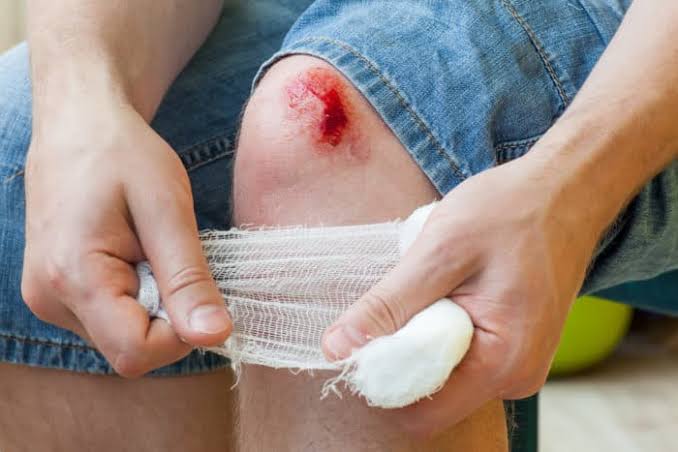 Penyakit Hemofilia, Gangguan Pembekuan Darah pada Tubuh Manusia