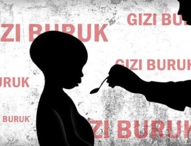 Duh! Ada 241 Kasus Gizi Buruk di Cianjur Selama Pandemi, Tiga di Antaranya Meninggal