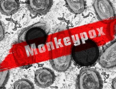 Dampak Cacar Monyet Berbahaya, Ini Ciri-Ciri dan Gejalanya