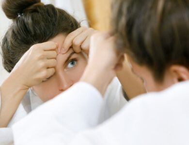 Penyebab jerawat dan Cara mengatasinya