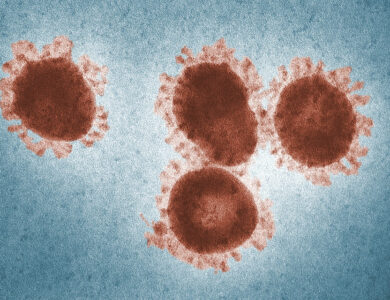 Jelaskan Dua Alasan yang Menyatakan Bahwa Virus Tidak Termasuk ke Dalam Makhluk Hidup