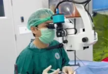 Metode Phacoemulsifikasi Kini Tersedia di RSUD Pagelaran, Operasi Katarak Hanya 10 Menit