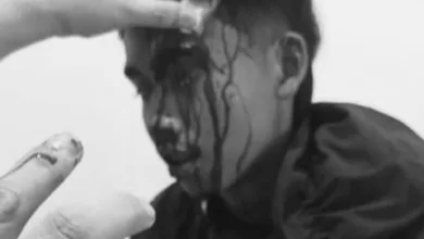 Seorang kurir Shopee Express saat menjalani perawatan medis setelah diduga menjadi korban pengeroyokan saat mengantarkan paket di wilayah Pasirkuda, Kabupaten Cianjur. Foto: Istimewa