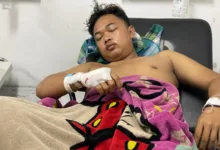 Lucky Irawan (21), korban pembacokan oleh gerombolan bermotor di Sukaluyu, mendapatkan perawatan intensif di rumah sakit, Minggu (18/1/2026). (Foto: Vito/Cianjur Update)