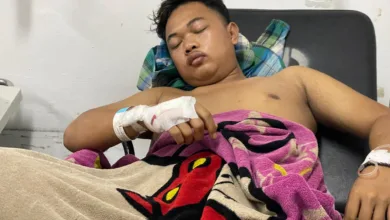 Lucky Irawan (21), korban pembacokan oleh gerombolan bermotor di Sukaluyu, mendapatkan perawatan intensif di rumah sakit, Minggu (18/1/2026). (Foto: Vito/Cianjur Update)