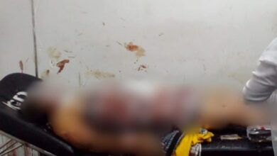 Korban luka bakar akibat dugaan ledakan gas di Gang Bakti, Sawah Gede, Cianjur, mendapatkan perawatan intensif di RSUD Sayang Cianjur. Empat orang terdampak, satu korban dirujuk ke RSHS Bandung karena mengalami luka bakar 100 persen. Foto: Istimewa