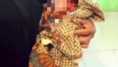 Saat ini, NA dan bayinya masih menjalani perawatan intensif di Puskesmas Sukanagara untuk menjalani observasi medis secara maksimal.